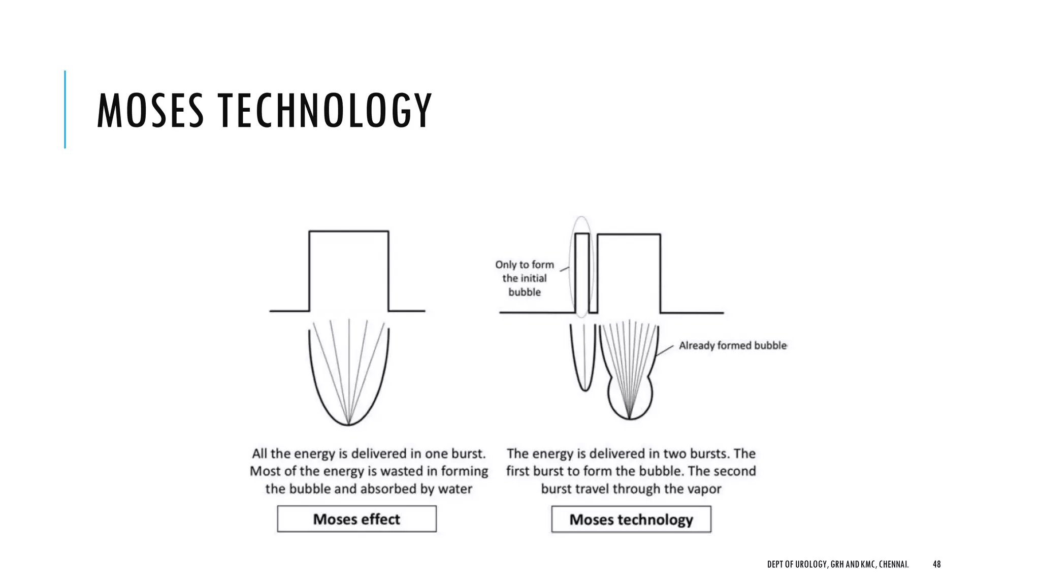 MOSES TECHNOLOGY
48
DEPT OF UROLOGY,GRH ANDKMC,CHENNAI.
 
