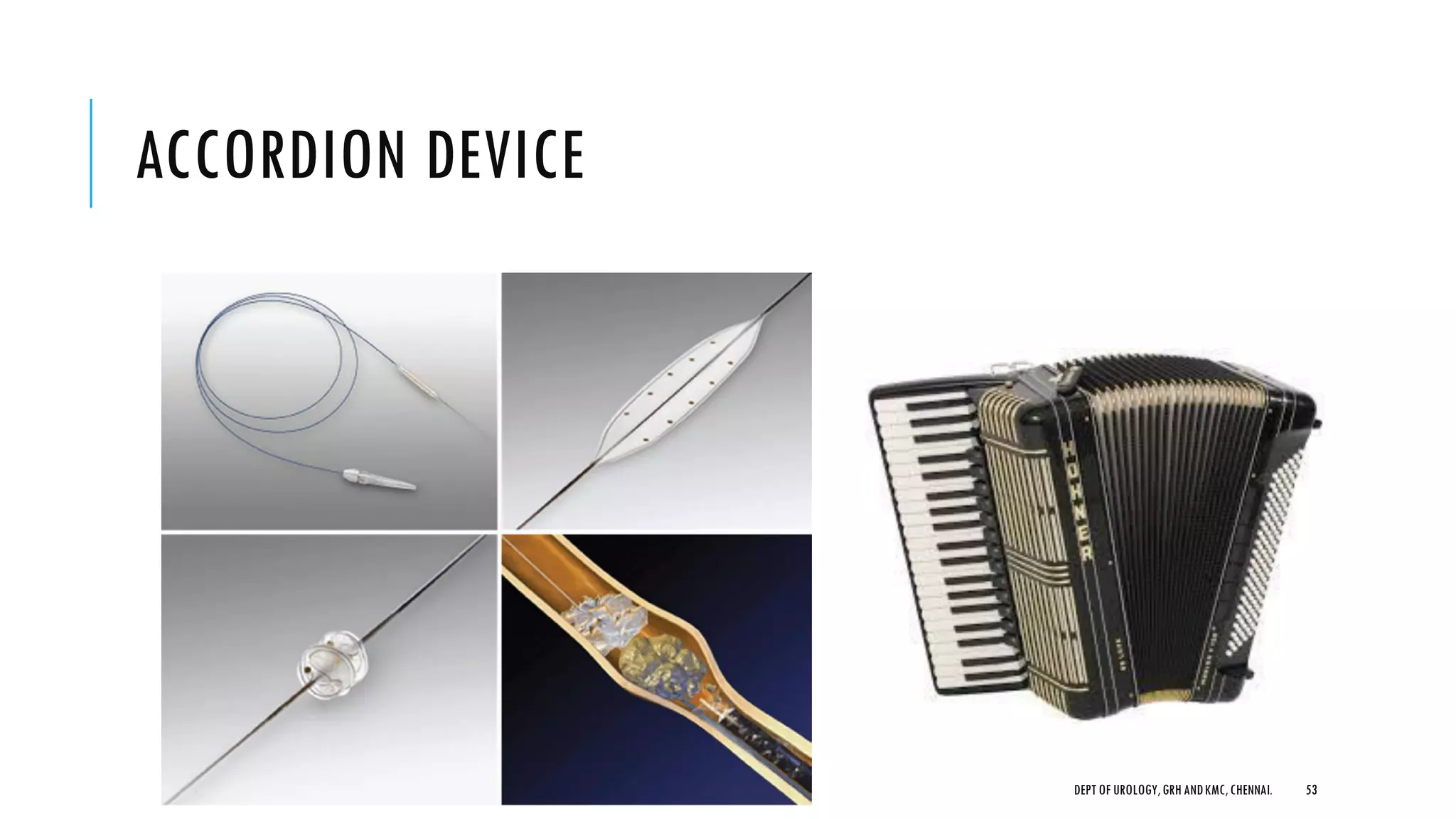 ACCORDION DEVICE
53
DEPT OF UROLOGY,GRH ANDKMC,CHENNAI.
 