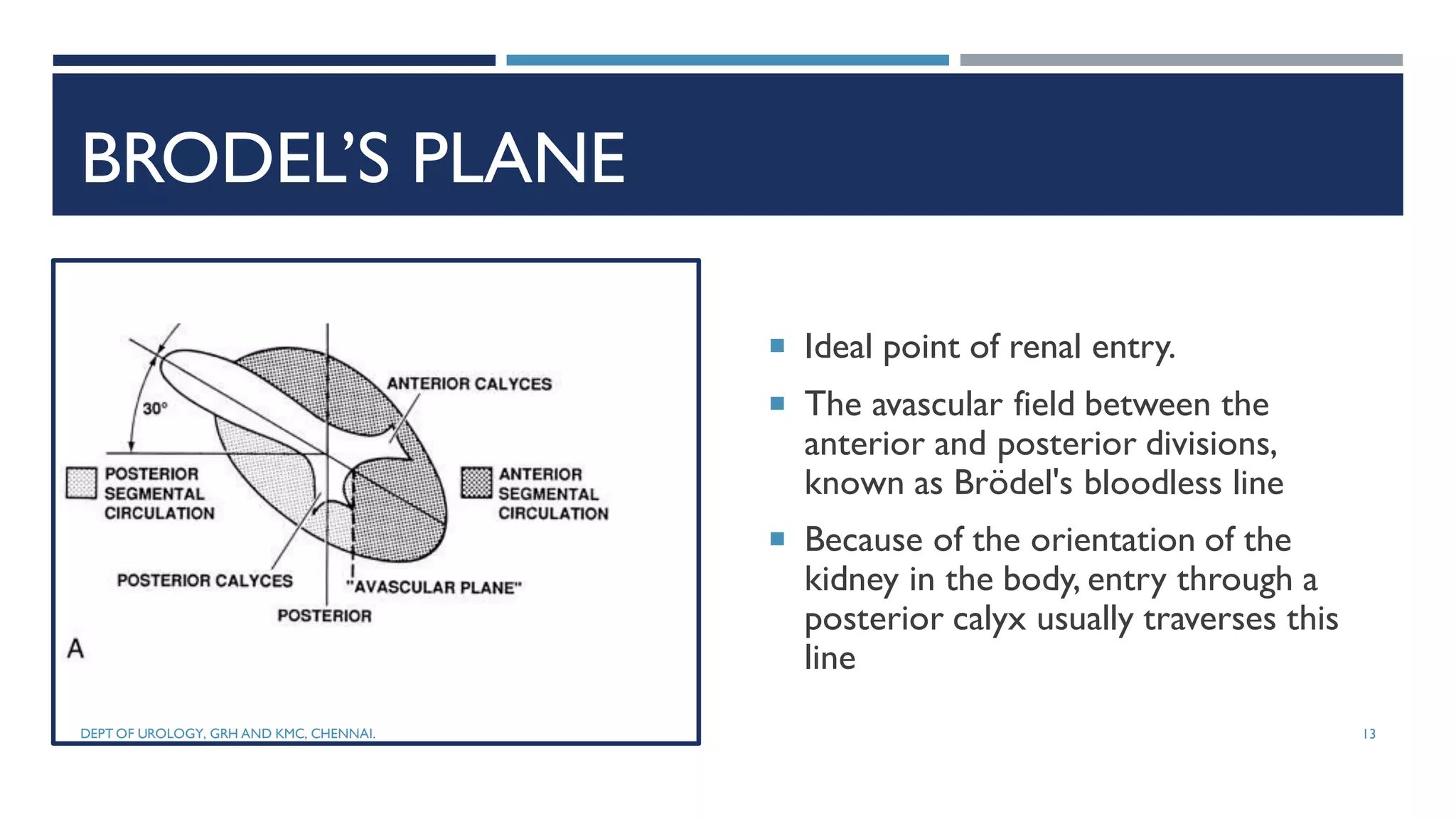 Urolithiasis management- pcnl | PDF
