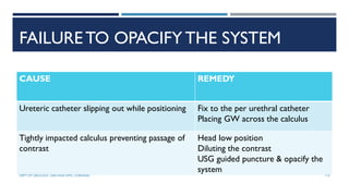 FAILURETO OPACIFY THE SYSTEM
CAUSE REMEDY
Ureteric catheter slipping out while positioning Fix to the per urethral catheter
Placing GW across the calculus
Tightly impacted calculus preventing passage of
contrast
Head low position
Diluting the contrast
USG guided puncture & opacify the
system
115
DEPT OF UROLOGY, GRH AND KMC, CHENNAI.
 