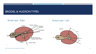 BRODEL & HUDSONTYPES
Brodel type - Right Hudson type - Left
14
DEPT OF UROLOGY, GRH AND KMC, CHENNAI.
 