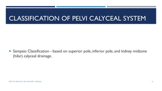 CLASSIFICATION OF PELVI CALYCEAL SYSTEM
 Sampaio Classification - based on superior pole, inferior pole, and kidney midzone
(hilar) calyceal drainage.
19
DEPT OF UROLOGY, GRH AND KMC, CHENNAI.
 