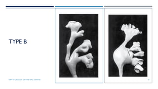 TYPE B
24
DEPT OF UROLOGY, GRH AND KMC, CHENNAI.
 