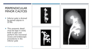 PERPENDICULAR
MINOR CALYCES
 Inferior pole is drained
by paired calyces in
57.9%
 This anatomic detail
must be kept in mind,
both to plan and
perform the intrarenal
access and endoscopic
procedures in the
inferior pole
32
DEPT OF UROLOGY, GRH AND KMC, CHENNAI.
 