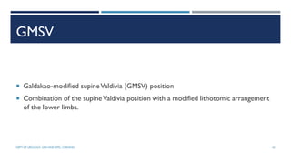 GMSV
 Galdakao‐modified supineValdivia (GMSV) position
 Combination of the supineValdivia position with a modified lithotomic arrangement
of the lower limbs.
42
DEPT OF UROLOGY, GRH AND KMC, CHENNAI.
 