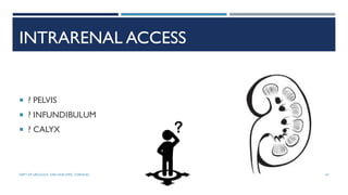 INTRARENAL ACCESS
 ? PELVIS
 ? INFUNDIBULUM
 ? CALYX
47
DEPT OF UROLOGY, GRH AND KMC, CHENNAI.
 