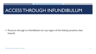 ACCESSTHROUGH INFUNDIBULUM
 Puncture through an infundibulum (in any region of the kidney) presents clear
hazards
49
DEPT OF UROLOGY, GRH AND KMC, CHENNAI.
 