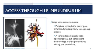 ACCESS THROUGH LP INFUNDIBULUM
Large venous anastomoses
Puncture through the lower pole
infundibulum risks injury to a venous
arcade
A venous lesion usually heals
spontaneously, but consequent
hemorrhage may be problematic
during the procedure.
56
DEPT OF UROLOGY, GRH AND KMC, CHENNAI.
 