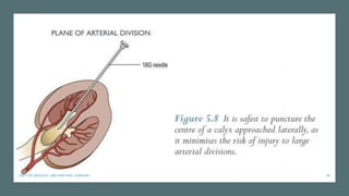 59
DEPT OF UROLOGY, GRH AND KMC, CHENNAI.
 