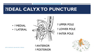 ?IDEAL CALYXTO PUNCTURE
? UPPER POLE
? LOWER POLE
? INTER POLE
? ANTERIOR
? POSTERIOR
• ? MEDIAL
• ? LATERAL
60
DEPT OF UROLOGY, GRH AND KMC, CHENNAI.
 