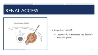 RENAL ACCESS
 Lateral or Medial?
 Lateral – As it traverses the Brodel’s
avascular plane
69
DEPT OF UROLOGY, GRH AND KMC, CHENNAI.
 