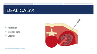 IDEAL CALYX
 Posterior
 Inferior pole
 Lateral
71
DEPT OF UROLOGY, GRH AND KMC, CHENNAI.
 