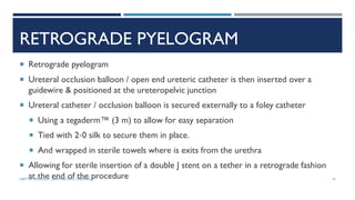 RETROGRADE PYELOGRAM
 Retrograde pyelogram
 Ureteral occlusion balloon / open end ureteric catheter is then inserted over a
guidewire & positioned at the ureteropelvic junction
 Ureteral catheter / occlusion balloon is secured externally to a foley catheter
 Using a tegaderm™ (3 m) to allow for easy separation
 Tied with 2‐0 silk to secure them in place.
 And wrapped in sterile towels where is exits from the urethra
 Allowing for sterile insertion of a double J stent on a tether in a retrograde fashion
at the end of the procedure 74
DEPT OF UROLOGY, GRH AND KMC, CHENNAI.
 