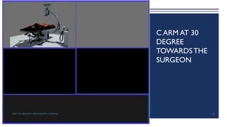 C ARM AT 30
DEGREE
TOWARDSTHE
SURGEON
80
DEPT OF UROLOGY, GRH AND KMC, CHENNAI.
 