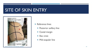 SITE OF SKIN ENTRY
 Reference lines
 Posterior axillary line
 Costal margin
 Iliac crest
 Mid scapular line
89
DEPT OF UROLOGY, GRH AND KMC, CHENNAI.
 