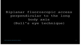 92
DEPT OF UROLOGY, GRH AND KMC, CHENNAI.
 