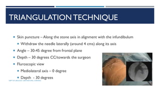 TRIANGULATION TECHNIQUE
 Skin puncture – Along the stone axis in alignment with the infundibulum
 Withdraw the needle laterally (around 4 cms) along its axis
 Angle – 30-45 degree from frontal plane
 Depth – 30 degrees CC/towards the surgeon
 Fluroscopic view
 Mediolateral axis – 0 degree
 Depth - 30 degrees
93
DEPT OF UROLOGY, GRH AND KMC, CHENNAI.
 
