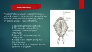 Urolithiasis presented by Dr Muhammad nouman([Autosaved]-1.pptx