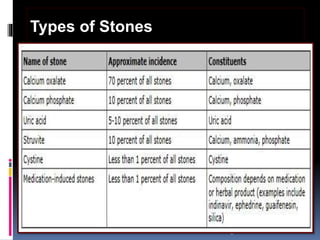 ©
Types of Stones
 