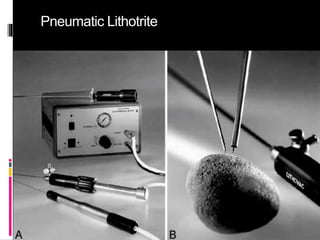 Pneumatic Lithotrite
 