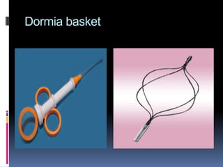 Dormia basket
 
