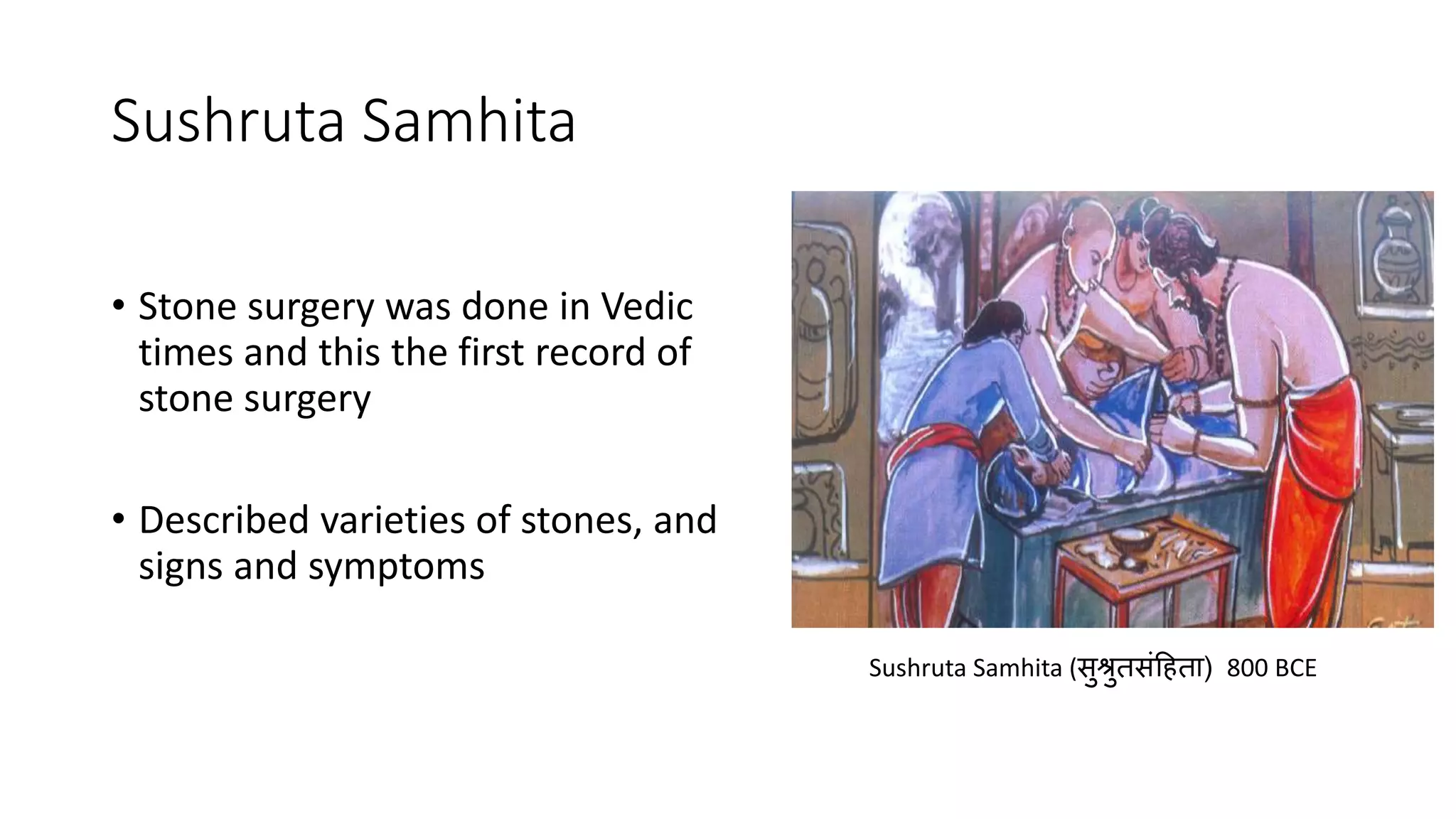 Sushruta Samhita
• Stone surgery was done in Vedic
times and this the first record of
stone surgery
• Described varieties of stones, and
signs and symptoms
Sushruta Samhita (सुश्रुतसंहिता) 800 BCE
 