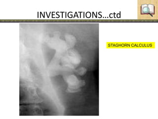 INVESTIGATIONS…ctd
STAGHORN CALCULUS
 