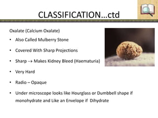 CLASSIFICATION…ctd
Oxalate (Calcium Oxalate)
• Also Called Mulberry Stone
• Covered With Sharp Projections
• Sharp Makes Kidney Bleed (Haematuria)
• Very Hard
• Radio – Opaque
• Under microscope looks like Hourglass or Dumbbell shape if
monohydrate and Like an Envelope if Dihydrate
 
