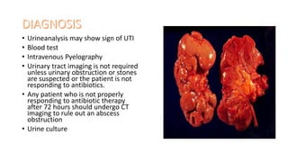 • Urineanalysis may show sign of UTI
• Blood test
• Intravenous Pyelography
• Urinary tract imaging is not required
unless urinary obstruction or stones
are suspected or the patient is not
responding to antibiotics.
• Any patient who is not properly
responding to antibiotic therapy
after 72 hours should undergo CT
imaging to rule out an abscess
obstruction
• Urine culture
 