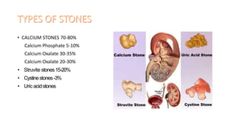 • CALCIUM STONES 70-80%
Calcium Phosphate 5-10%
Calcium Oxalate 30-35%
Calcium Oxalate 20-30%
• Struvite stones15-20%
• Cystinestones -3%
• Uric acidstones
 