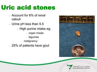  Account for 6% of renal
calculi
 Urine pH less than 5.5
 High purine intake eg.
 organ meats
 legumes
 malignancy
 25% of patients have gout
Uric acid stones
 
