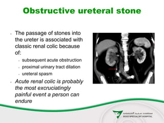  The passage of stones into
the ureter is associated with
classic renal colic because
of:
 subsequent acute obstruction
 proximal urinary tract dilation
 ureteral spasm
 Acute renal colic is probably
the most excruciatingly
painful event a person can
endure
Obstructive ureteral stone
 