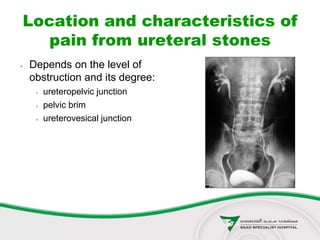 Location and characteristics of
pain from ureteral stones
 Depends on the level of
obstruction and its degree:
 ureteropelvic junction
 pelvic brim
 ureterovesical junction
 