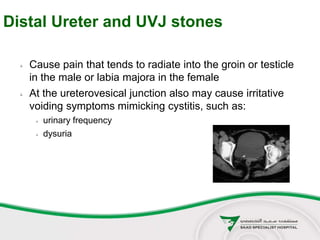 Distal Ureter and UVJ stones
 Cause pain that tends to radiate into the groin or testicle
in the male or labia majora in the female
 At the ureterovesical junction also may cause irritative
voiding symptoms mimicking cystitis, such as:
 urinary frequency
 dysuria
 