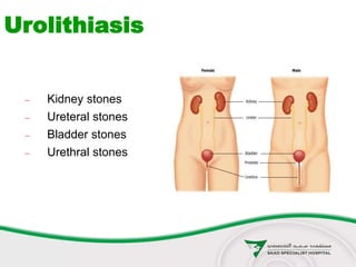  Kidney stones
 Ureteral stones
 Bladder stones
 Urethral stones
Urolithiasis
 