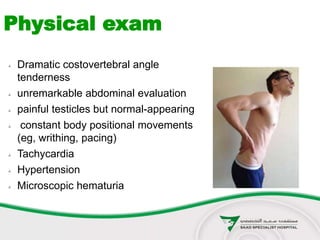  Dramatic costovertebral angle
tenderness
 unremarkable abdominal evaluation
 painful testicles but normal-appearing
 constant body positional movements
(eg, writhing, pacing)
 Tachycardia
 Hypertension
 Microscopic hematuria
Physical exam
 