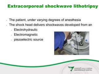 Extracorporeal shockwave lithotripsy
 The patient, under varying degrees of anesthesia
 The shock head delivers shockwaves developed from an
 Electrohydraulic
 Electromagnetic
 piezoelectric source
 
