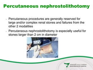 Percutaneous nephrostolithotomy
 Percutaneous procedures are generally reserved for
large and/or complex renal stones and failures from the
other 2 modalities
 Percutaneous nephrostolithotomy is especially useful for
stones larger than 2 cm in diameter
 