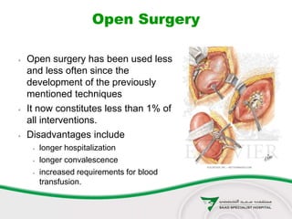 Open Surgery
 Open surgery has been used less
and less often since the
development of the previously
mentioned techniques
 It now constitutes less than 1% of
all interventions.
 Disadvantages include
 longer hospitalization
 longer convalescence
 increased requirements for blood
transfusion.
 