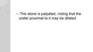  -The stone is palpated, noting that the
ureter proximal to it may be dilated.
 
