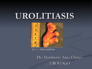 UROLITIASIS



    Dr.: Humberto Añez Chavez
           UROLOGO
 