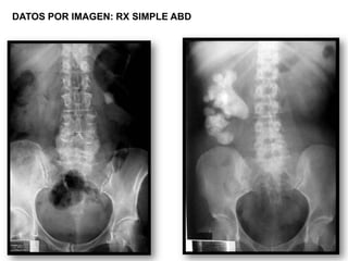 DATOS POR IMAGEN: RX SIMPLE ABD
 