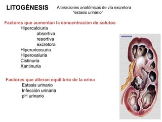 LITOGÉNESIS             Alteraciones anatómicas de vía excretora
                                 “estasis urinario”

Factores que aumentan la concentración de solutos
       Hipercalciuria
                absortiva
                resortiva
                excretora
       Hiperuricosuria
       Hiperoxaluria
       Cistinuria
       Xantinuria


Factores que alteran equilibrio de la orina
       Estasis urinario
       Infección urinaria
       pH urinario
 