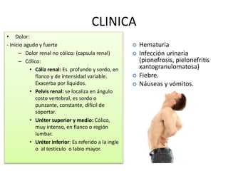 CLINICA 
• Dolor: 
- Inicio agudo y fuerte 
– Dolor renal no cólico: (capsula renal) 
– Cólico: 
• Cáliz renal: Es profundo y sordo, en 
flanco y de intensidad variable. 
Exacerba por líquidos. 
• Pelvis renal: se localiza en ángulo 
costo vertebral, es sordo o 
punzante, constante, difícil de 
soportar. 
• Uréter superior y medio: Cólico, 
muy intenso, en flanco o región 
lumbar. 
• Uréter inferior: Es referido a la ingle 
o al testículo o labio mayor. 
 Hematuria 
 Infección urinaria 
(pionefrosis, pielonefritis 
xantogranulomatosa) 
 Fiebre. 
 Náuseas y vómitos. 
 