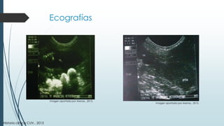 Ecografías
Historia clínica CUV., 2015
Imagen aportada por Arenas., 2015.
Imagen aportada por Arenas., 2015.
 