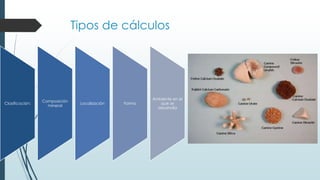 Tipos de cálculos
Clasificación:
Composición
mineral
Localización Forma
Ambiente en el
que se
desarrolla
 