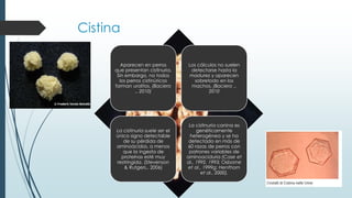 Cistina
Aparecen en perros
que presentan cistinuria.
Sin embargo, no todos
los perros cistinúricos
forman urolitos. (Baciero
., 2010)
Los cálculos no suelen
detectarse hasta la
madurez y aparecen
sobretodo en los
machos. (Baciero .,
2010
La cistinuria suele ser el
único signo detectable
de su pérdida de
aminoácidos, a menos
que la ingesta de
proteínas esté muy
restringida. (Stevenson
& Rutgers., 2006)
La cistinuria canina es
genéticamente
heterogénea y se ha
detectado en más de
60 razas de perros con
patrones variables de
aminoaciduria (Case et
al., 1992, 1993; Osborne
et al., 1999g; Henthorn
et al., 2000).
 