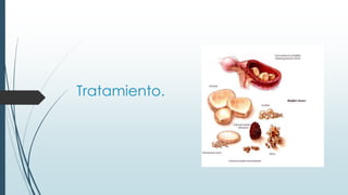 Tratamiento.
 