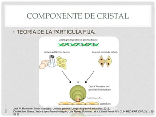 COMPONENTE DE CRISTAL
• TEORÍA DE LA PARTICULA FIJA.
1. Jack W. McAninch. Smith y tanagho. Urología general. Lange Mc graw hill education. 2013.
2. Clotilde Boix Grasa , Jesús López-Torres Hidalgob , Luis Álvarez Dumontc , et al. Litiasis Renal REV CLÍN MED FAM 2007; 2 (1): 32-
38 32.
 