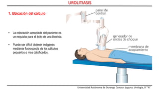Universidad Autónoma de Durango Campus Laguna, Urología, 9° “A”
UROLITIASIS
1. Ubicación del cálculo
• La colocación apropiada del paciente es
un requisito para el éxito de una litotricia.
• Puede ser difícil obtener imágenes
mediante fluoroscopia de los cálculos
pequeños o mas calcificados.
 